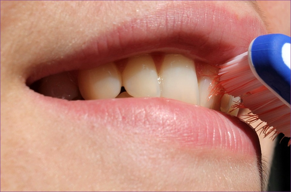 Erősen kell dörzsölni a fogakat vagy épp ellenkezőleg?