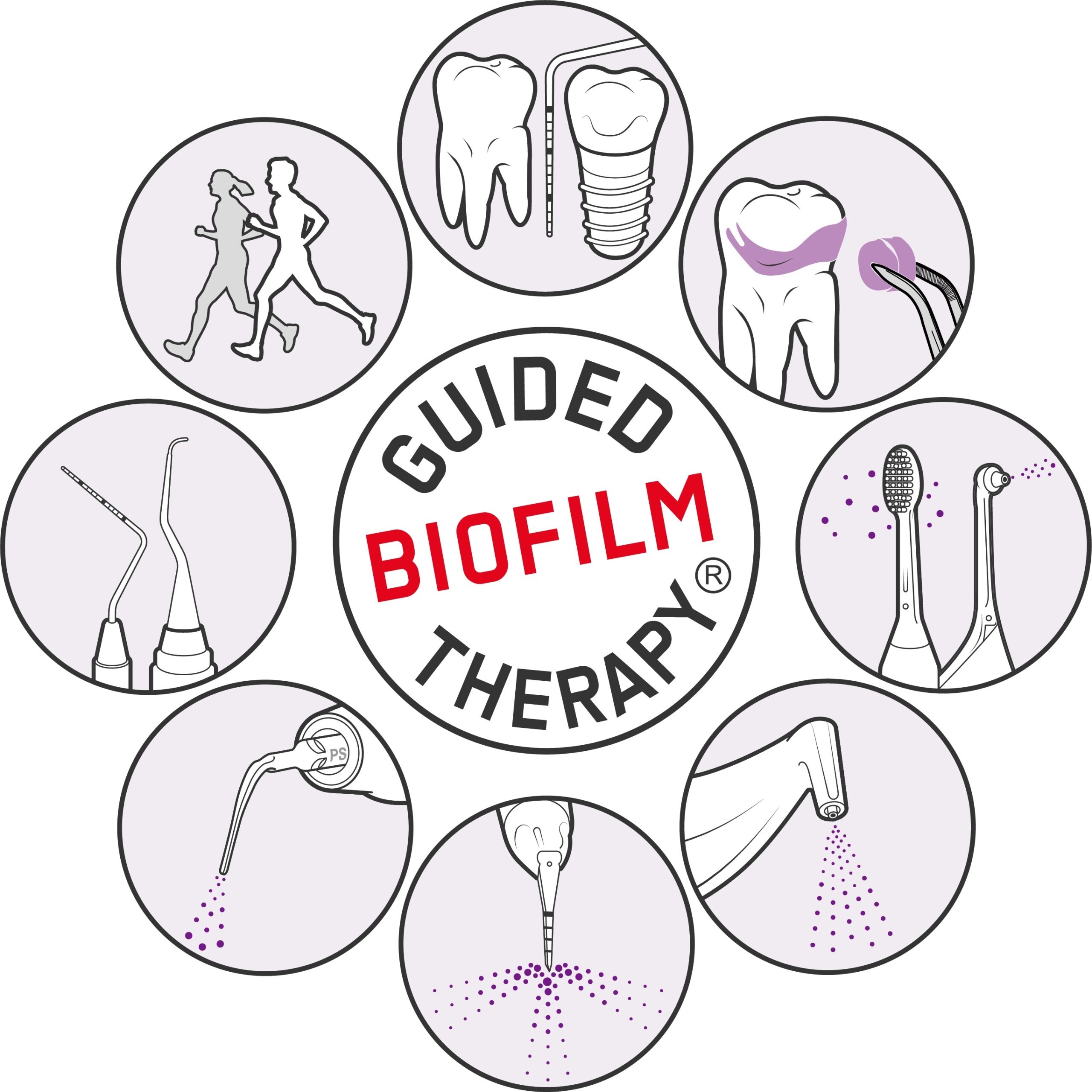 Guided Biofilm Therapy Irányított Biofilm Terápia Implantátumos Fogpótlás