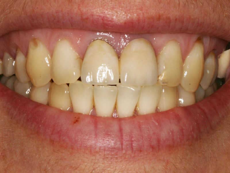  páciensünk ilyen fogakkal kereste fel klinikánkat,
