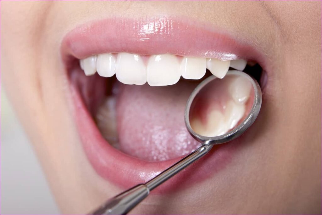 Ízületek egy foga miatt, A rossz fogíny miatt fájnak az ízületek?